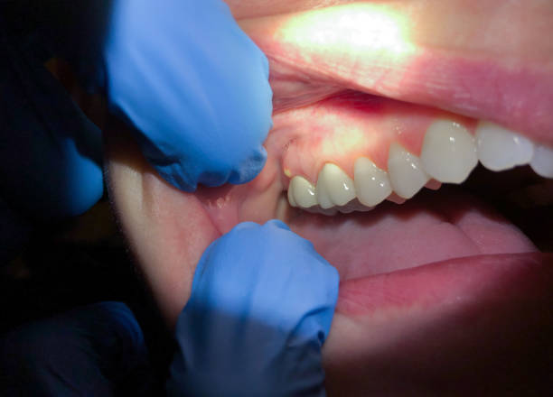 Dentist for Dental Trauma in CA