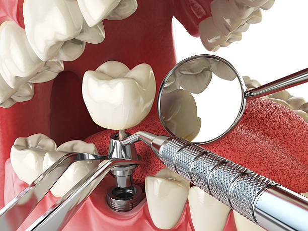 Best Emergency Gum Pain Relief  in Upper Lake, CA
