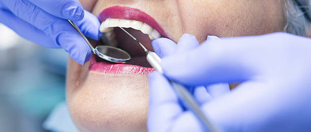 Best Chipped Tooth Repair Near Me  in Upper Lake, CA